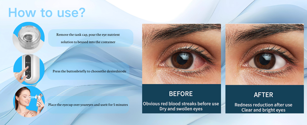 NoAging Eye Mist Steam Sprayer for Relief Dry Eyes, Eye Treatment, Portable Heated Eye Masks, Mini Eye Moisturizing Cleaning Soothing Steamer