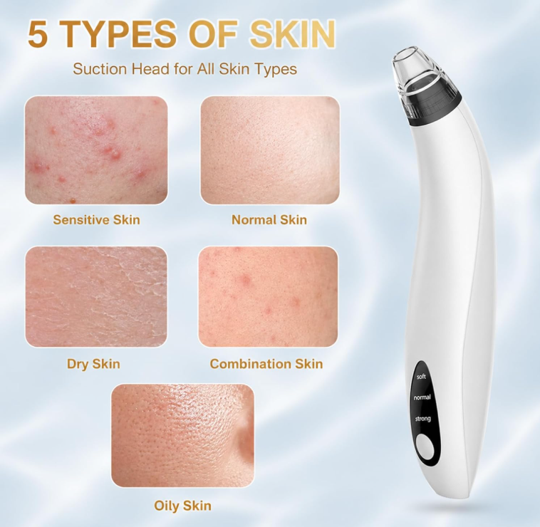NoAging Blackhead Remover Tools Vacuum Facial Pore Cleaner Tool 3 Suction Power |  interchangeable probes USB rechargeable pore vacuum kit for facial deep cleansing, suitable for adults