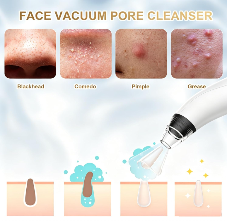 NoAging Blackhead Remover Tools Vacuum Facial Pore Cleaner Tool 3 Suction Power |  interchangeable probes USB rechargeable pore vacuum kit for facial deep cleansing, suitable for adults