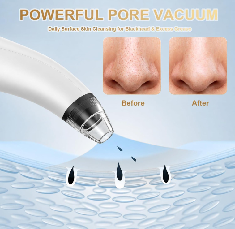 NoAging Blackhead Remover Tools Vacuum Facial Pore Cleaner Tool 3 Suction Power |  interchangeable probes USB rechargeable pore vacuum kit for facial deep cleansing, suitable for adults