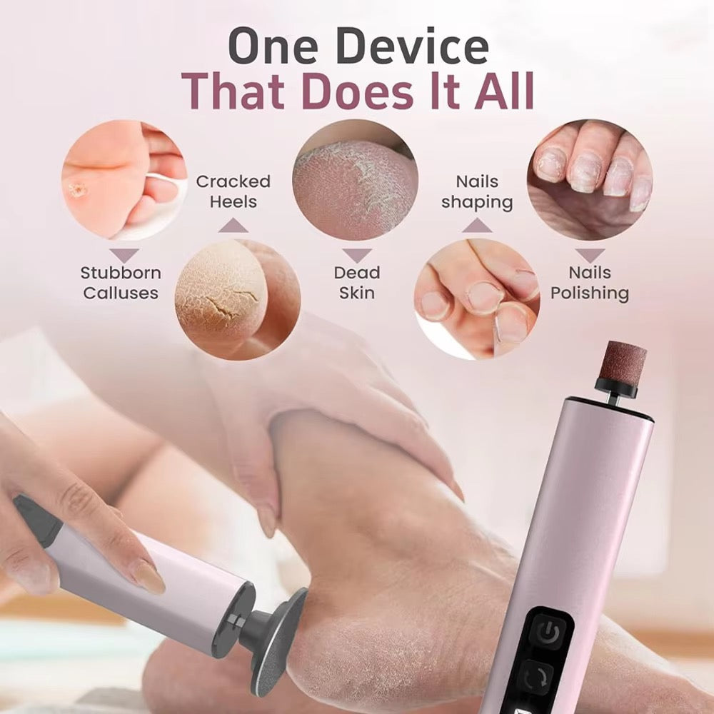 NoAging APRELM Electric Foot Callus Remover with 80pcs Sandpaper Discs, 4.8IN Longer Professional Callus Remover for Feet, Pedicure Tools Foot File for Dead Skin